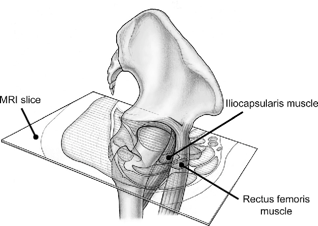 Silvrback blog image