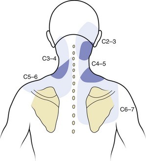 Silvrback blog image